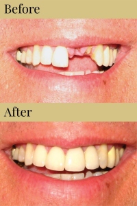 CDIC_Before_After_Photos_11_19_18-01