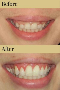 CDIC_Before_After_Photos_11_19_18-02