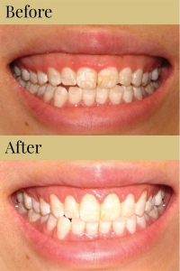 CDIC_Before_After_Photos_11_19_18-03