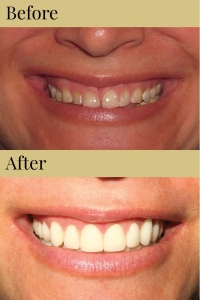CDIC_Before_After_Photos_11_19_18-04