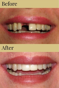 CDIC_Before_After_Photos_11_19_18-05