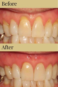 CDIC_Before_After_Photos_11_19_18-06